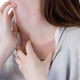 Keto Rash: Why It Happens and What Can Help