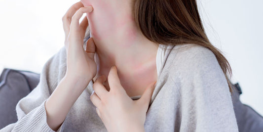 Keto Rash: Why It Happens and What Can Help